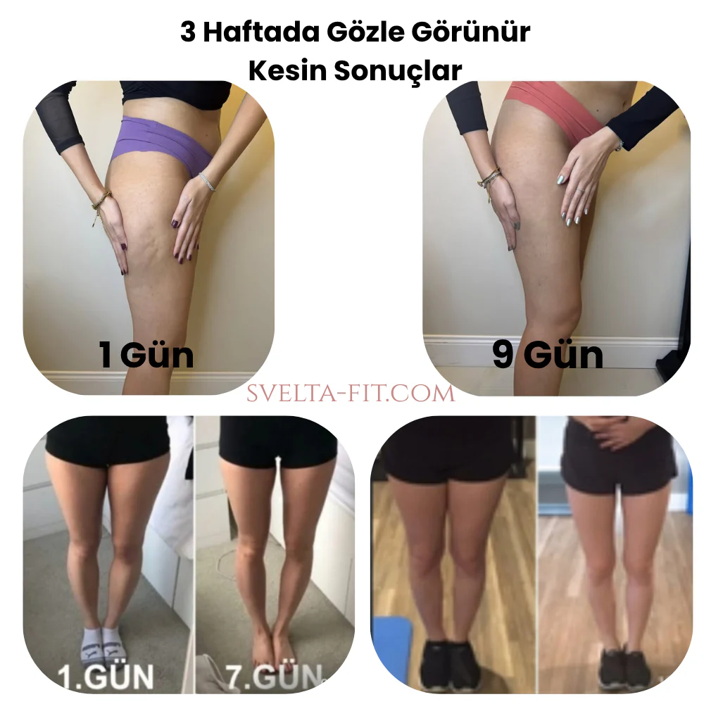 Svelta-Fit Bacak İncelten Masaj Aleti